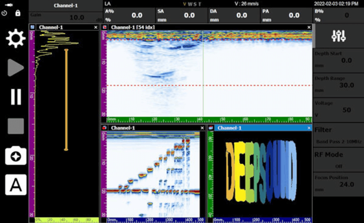 Linear Scan Multi-View (A/B/C-Scan)