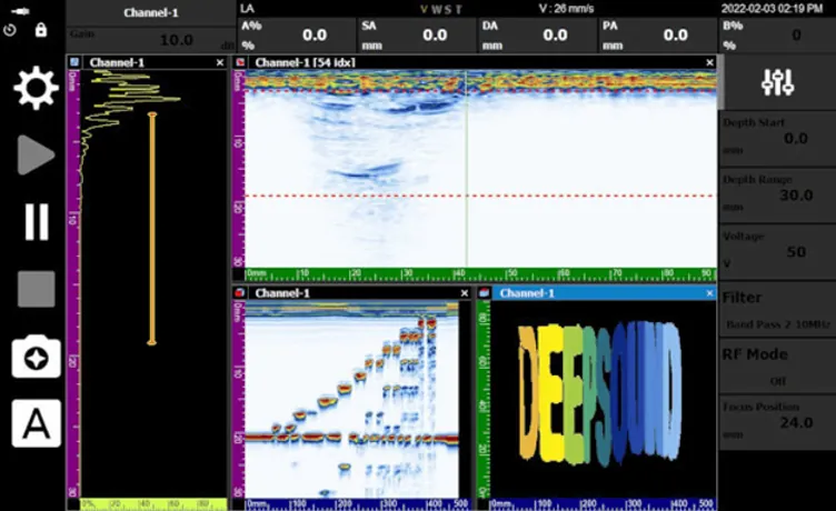 Linear Scan Multi-View (A/B/C-Scan)